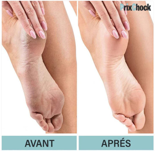 Lime À Pied Électrique Pour Nettoyage De La Peau Dure Et Morte De Talons Et Ongles À 2 Rouleau