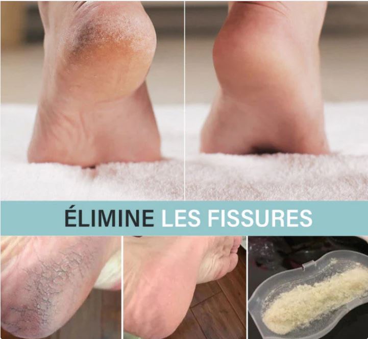 Lime À Pied Électrique Pour Nettoyage De La Peau Dure Et Morte De Talons Et Ongles À 2 Rouleau