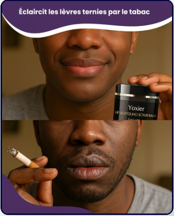 Yoxier™ Sérum éclaircissant pour lèvres